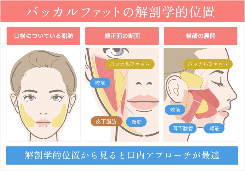 バッカルファットの解剖学的位置