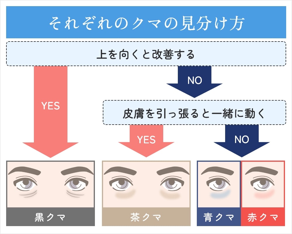 それぞれのクマの見分け方