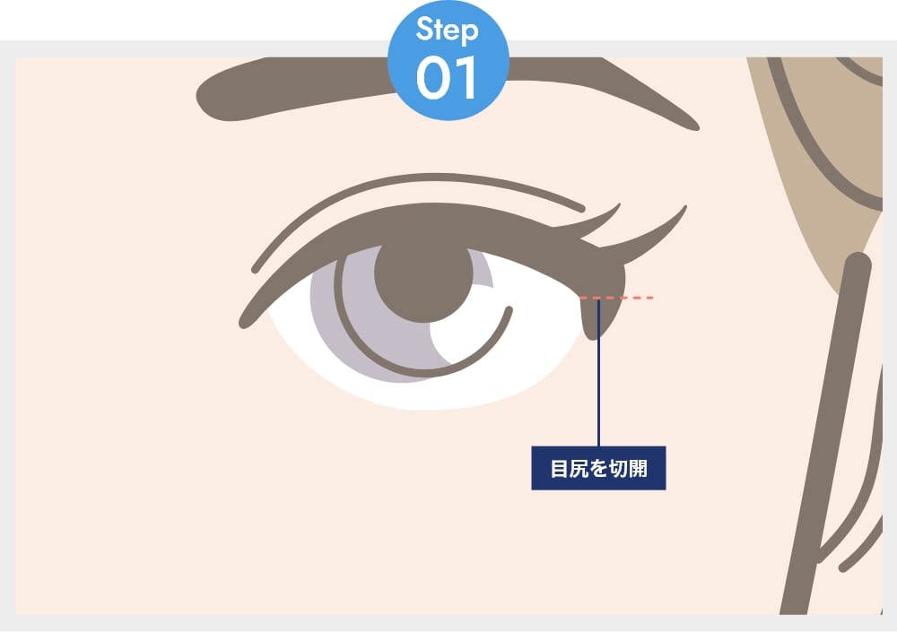ステップ01