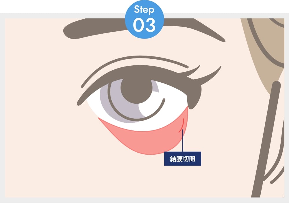 ステップ03