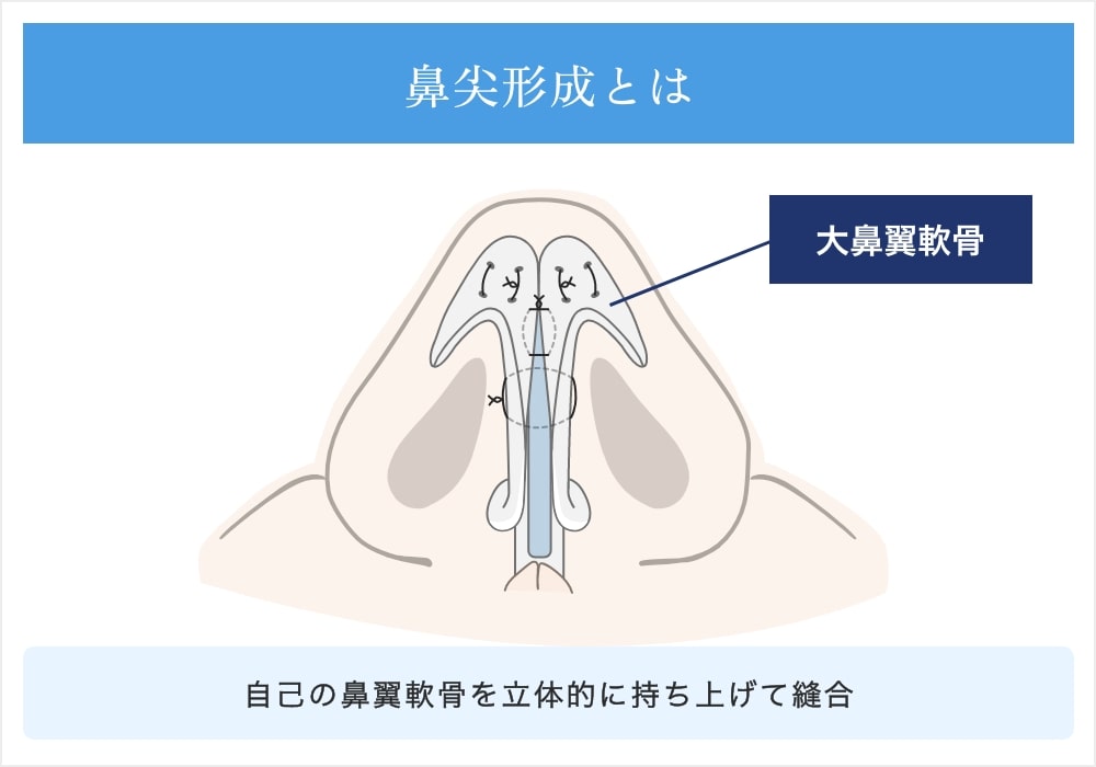 鼻尖形成