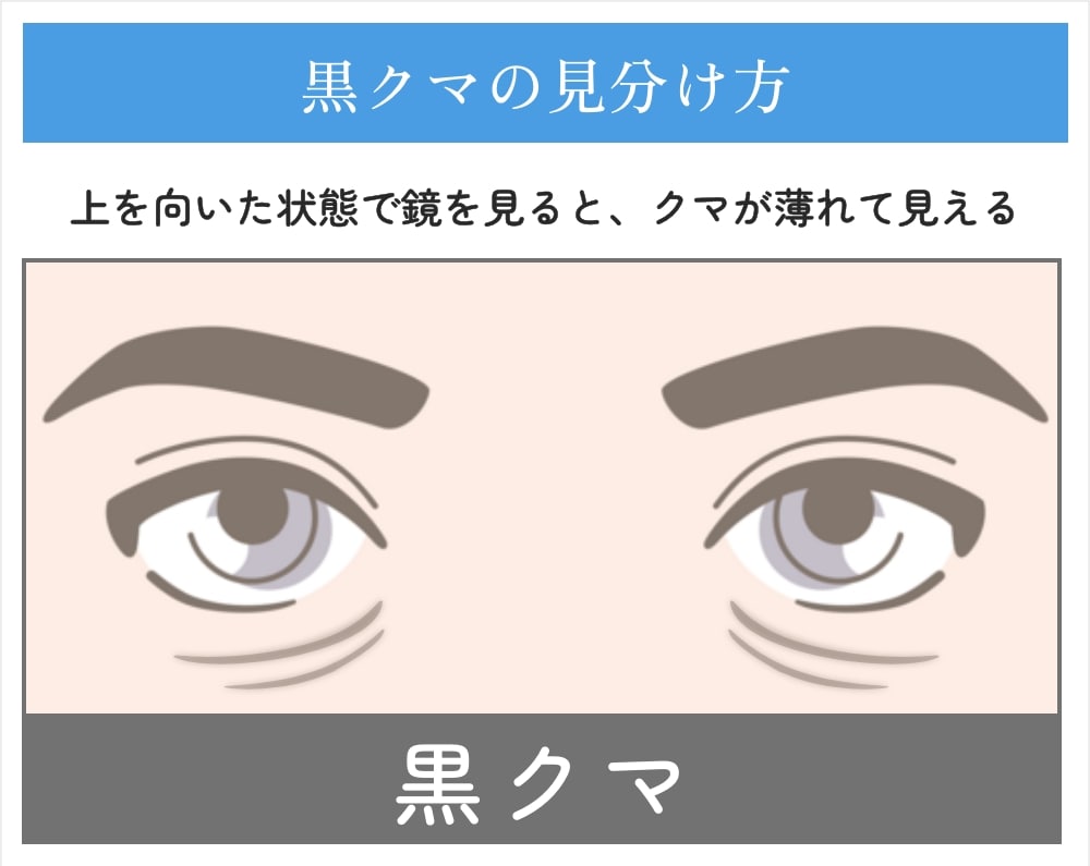 黒クマの見分け方解説
