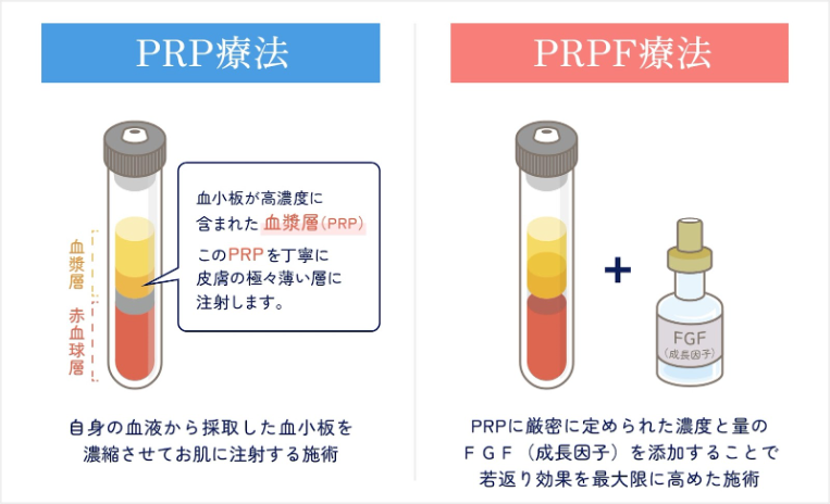 PHP療法とPRPF療法の特徴の説明