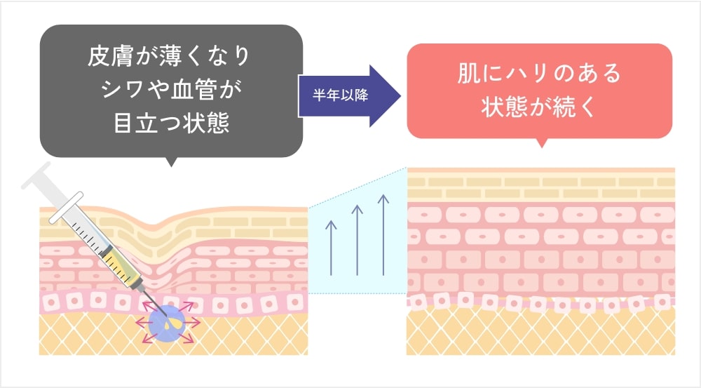 PRPF®療法とは