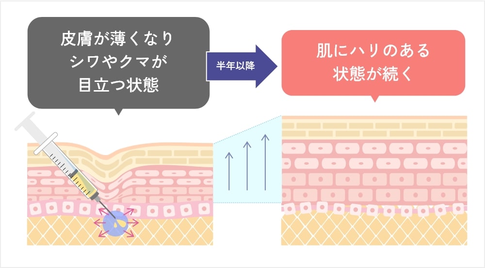 PRPF®療法